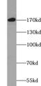 TUB Like Protein 4 antibody, FNab09110, FineTest, Western Blot image 