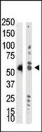 TRNA Aspartic Acid Methyltransferase 1 antibody, PA5-11138, Invitrogen Antibodies, Western Blot image 