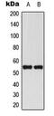 RUNX Family Transcription Factor 1 antibody, MBS8229507, MyBioSource, Western Blot image 