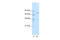 Tripartite Motif Containing 35 antibody, 28-209, ProSci, Western Blot image 