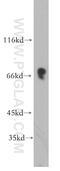 Potassium Voltage-Gated Channel Subfamily D Member 2 antibody, 21298-1-AP, Proteintech Group, Western Blot image 