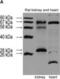 NADPH Oxidase 4 antibody, NB110-58851, Novus Biologicals, Western Blot image 