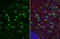 Interleukin 1 Beta antibody, GTX74034, GeneTex, Immunohistochemistry paraffin image 