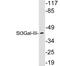 ST3 Beta-Galactoside Alpha-2,3-Sialyltransferase 3 antibody, A08054, Boster Biological Technology, Western Blot image 