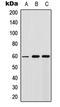 Akt antibody, LS-C358911, Lifespan Biosciences, Western Blot image 