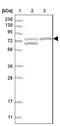 Taste 1 Receptor Member 1 antibody, NBP1-83338, Novus Biologicals, Western Blot image 