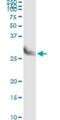 Chloride Intracellular Channel 3 antibody, H00009022-M02, Novus Biologicals, Immunoprecipitation image 