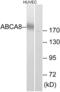 ATP Binding Cassette Subfamily A Member 8 antibody, abx014228, Abbexa, Western Blot image 