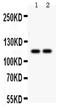 Sarcoplasmic/endoplasmic reticulum calcium ATPase 3 antibody, PA5-78838, Invitrogen Antibodies, Western Blot image 