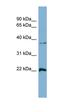 RAN, Member RAS Oncogene Family antibody, orb330885, Biorbyt, Western Blot image 