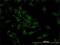 Cofilin 2 antibody, H00001073-M03, Novus Biologicals, Immunofluorescence image 