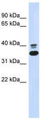 Epoxide Hydrolase 4 antibody, TA331395, Origene, Western Blot image 