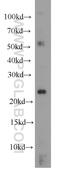 Ras Homolog Family Member C antibody, 10632-1-AP, Proteintech Group, Western Blot image 