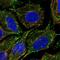 CAP-Gly Domain Containing Linker Protein 1 antibody, NBP1-85568, Novus Biologicals, Immunofluorescence image 