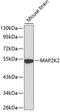 Mitogen-Activated Protein Kinase Kinase 2 antibody, 13-107, ProSci, Western Blot image 