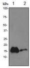 Transthyretin antibody, ab92469, Abcam, Western Blot image 