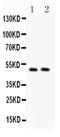 c-Myc antibody, PA1555, Boster Biological Technology, Western Blot image 