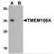 Transmembrane protein 106A antibody, MBS150422, MyBioSource, Western Blot image 