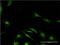 WW Domain Binding Protein 2 antibody, H00023558-M02, Novus Biologicals, Immunocytochemistry image 