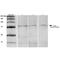 ADAM Metallopeptidase Domain 22 antibody, MA5-27623, Invitrogen Antibodies, Western Blot image 