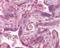 Polo Like Kinase 1 antibody, NB100-56651, Novus Biologicals, Immunohistochemistry paraffin image 