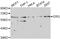 ETS Transcription Factor ERG antibody, MBS127959, MyBioSource, Western Blot image 