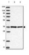 Nucleolar Protein Interacting With The FHA Domain Of MKI67 antibody, NBP2-48643, Novus Biologicals, Western Blot image 