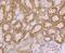 Tyrosine Kinase 2 antibody, NBP2-76968, Novus Biologicals, Immunohistochemistry frozen image 