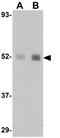 Nuclear Receptor Subfamily 1 Group H Member 2 antibody, GTX31398, GeneTex, Western Blot image 