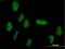 Zinc Finger And SCAN Domain Containing 9 antibody, H00007746-B01P, Novus Biologicals, Immunocytochemistry image 