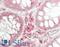TNF Receptor Associated Factor 4 antibody, LS-B14710, Lifespan Biosciences, Immunohistochemistry paraffin image 