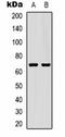 CIP75 antibody, orb75240, Biorbyt, Western Blot image 