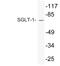 Solute Carrier Family 5 Member 1 antibody, LS-C200002, Lifespan Biosciences, Western Blot image 