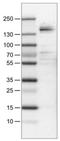 Macrophage Stimulating 1 Receptor antibody, NBP2-30924, Novus Biologicals, Western Blot image 