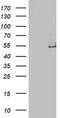 Lipoprotein Lipase antibody, CF503791, Origene, Western Blot image 