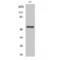 Cholinergic Receptor Nicotinic Alpha 5 Subunit antibody, LS-C381873, Lifespan Biosciences, Western Blot image 