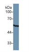 Keratin 8 antibody, LS-C304665, Lifespan Biosciences, Western Blot image 