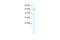 Zinc Finger Protein 182 antibody, 27-874, ProSci, Western Blot image 