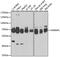 Heterogeneous Nuclear Ribonucleoprotein L antibody, 23-578, ProSci, Western Blot image 