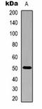 Alliinase antibody, orb323209, Biorbyt, Western Blot image 