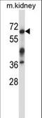Interleukin 1 Receptor Associated Kinase 3 antibody, LS-C164428, Lifespan Biosciences, Western Blot image 
