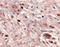 Matrix metalloproteinase-24 antibody, AB924, R&D Systems, Immunohistochemistry paraffin image 
