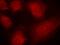 Coactivator Associated Arginine Methyltransferase 1 antibody, GTX50685, GeneTex, Immunofluorescence image 