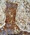 Matrix Metallopeptidase 2 antibody, abx025202, Abbexa, Immunohistochemistry paraffin image 