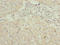 Ankyrin Repeat Family A Member 2 antibody, LS-C398498, Lifespan Biosciences, Immunohistochemistry paraffin image 