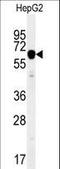 VICKZ family member 2 antibody, LS-C165146, Lifespan Biosciences, Western Blot image 