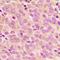 Insulin Receptor Substrate 1 antibody, orb315569, Biorbyt, Immunohistochemistry paraffin image 