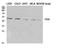 Phosphatase And Tensin Homolog antibody, STJ95259, St John
