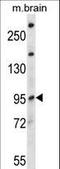 NEDD4 Like E3 Ubiquitin Protein Ligase antibody, LS-C164819, Lifespan Biosciences, Western Blot image 