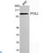Protein Tyrosine Kinase 2 Beta antibody, LS-C813105, Lifespan Biosciences, Western Blot image 